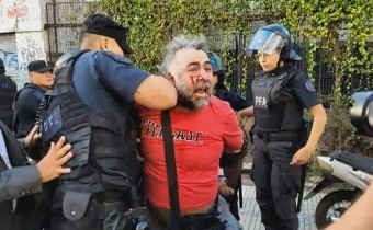 La Policía hirió y detuvo a un camarógrafo de A24 frente al Congreso